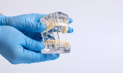 Implanty zębów powikłania