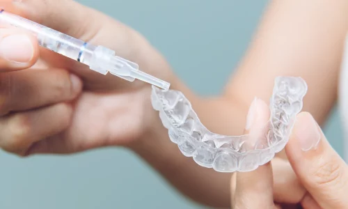 Invisalign Lublin cena