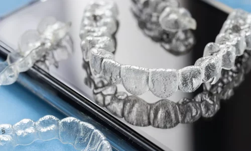 Nakładki Invisalign Lublin