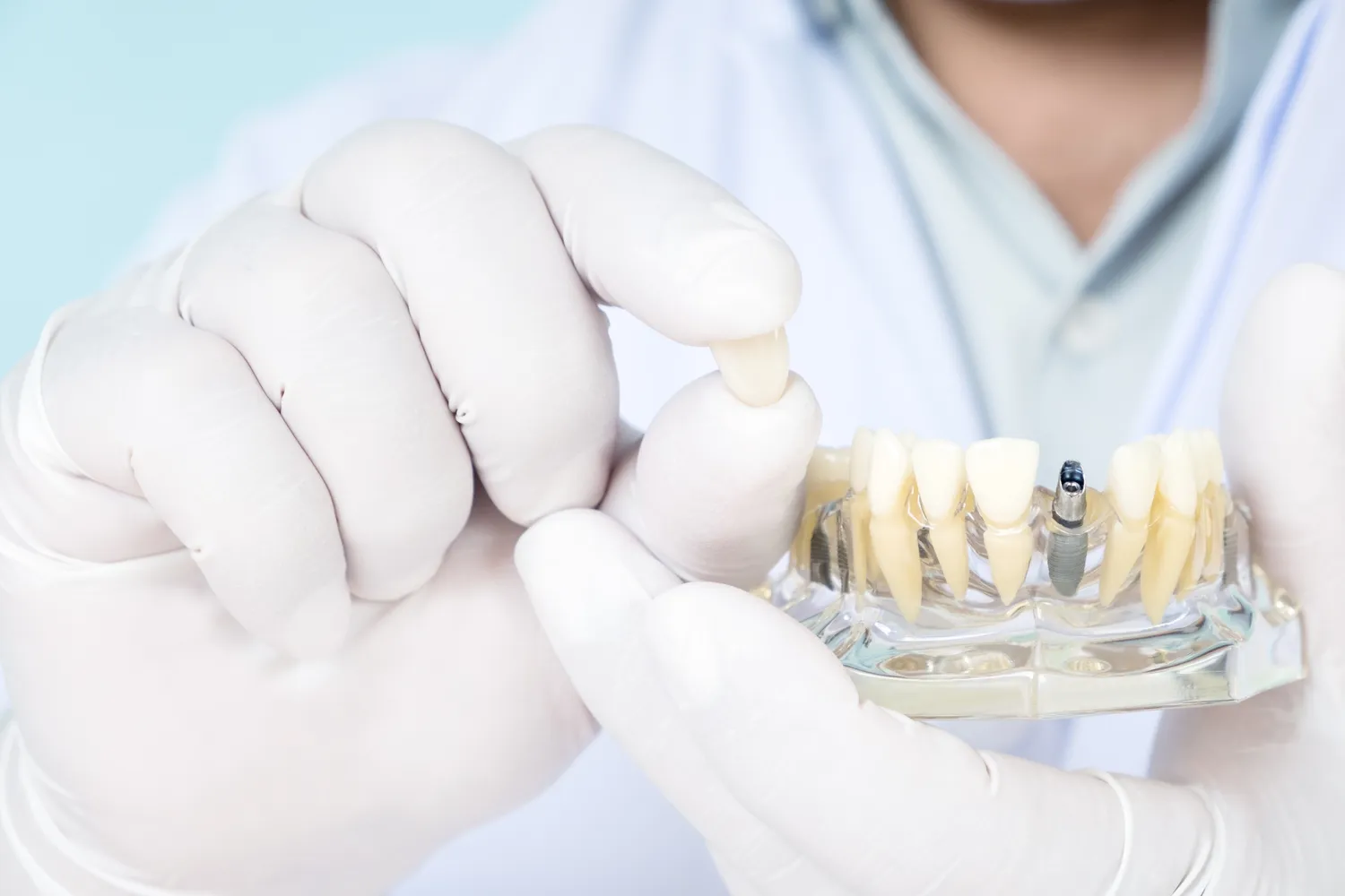 Endodoncja mikroskopowa Szczecin
