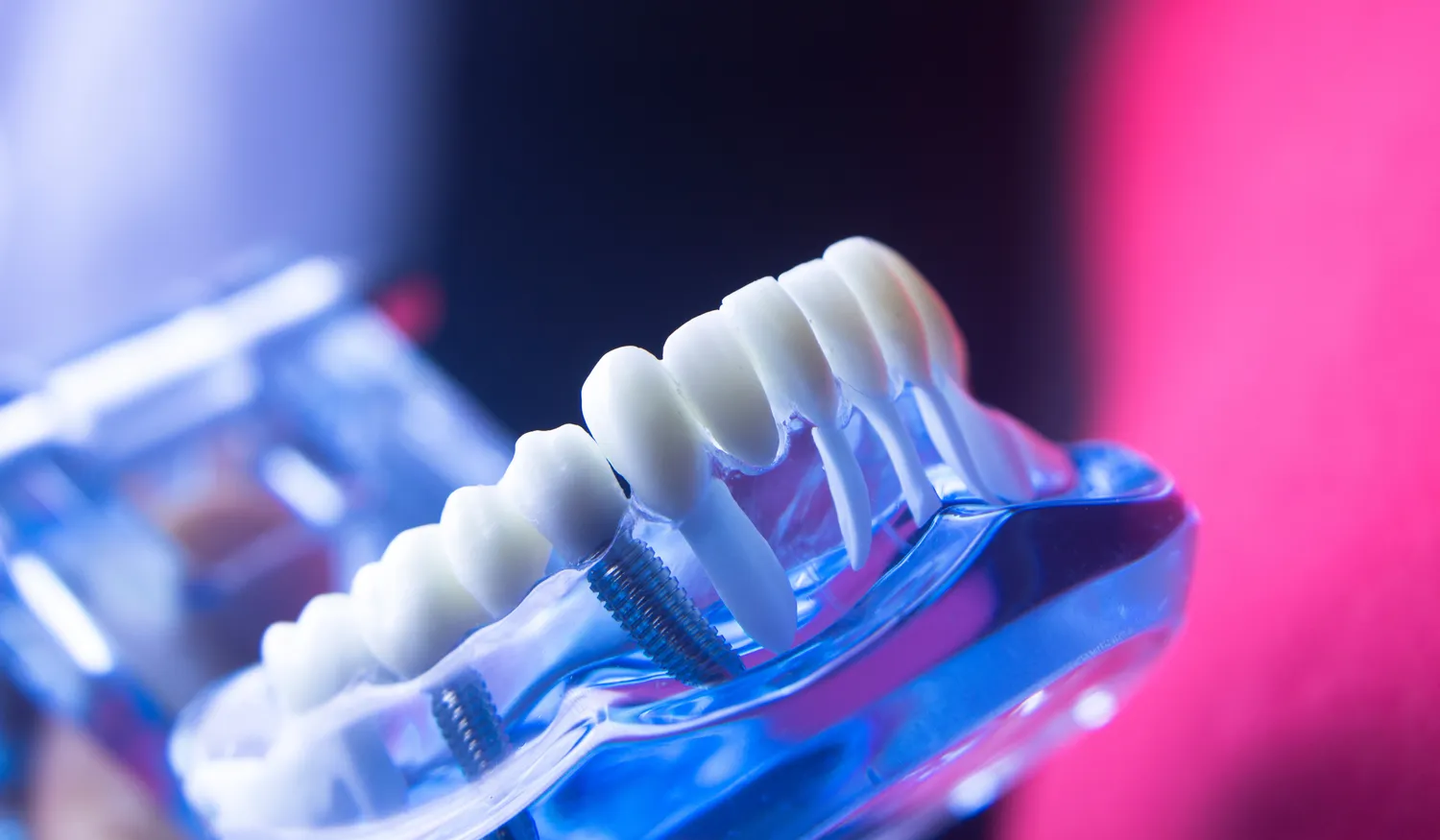 Endodoncja mikroskopowa Szczecin