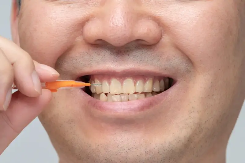 Endodoncja Szczecin