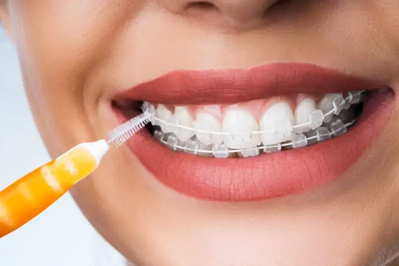 Endodoncja Szczecin