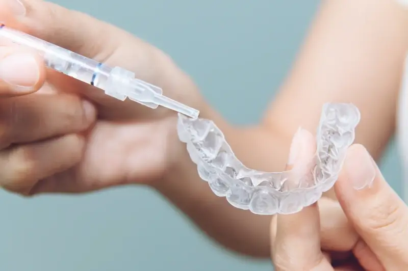 Zabiegi dentystyczne refundowane przez NFZ