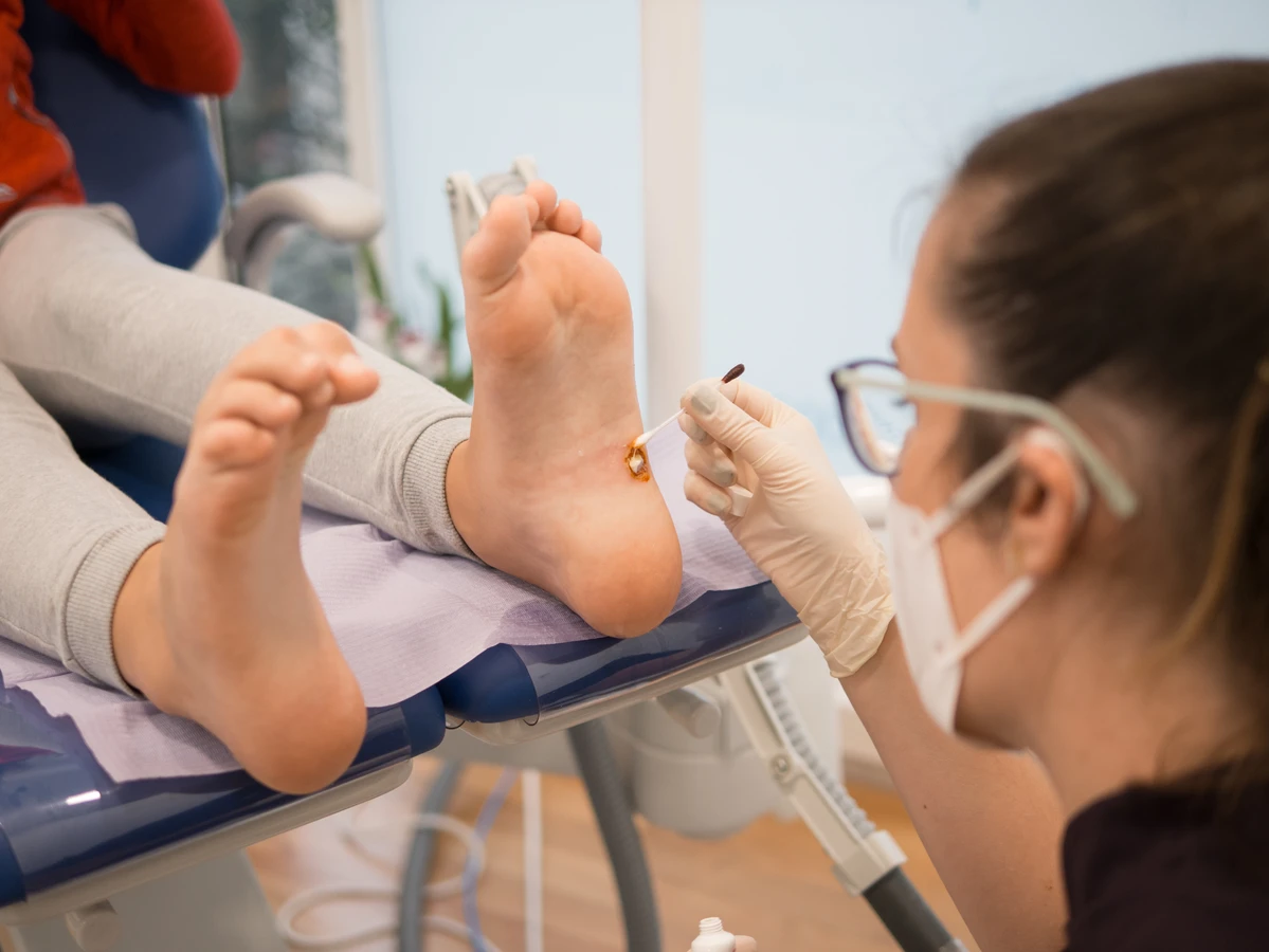 Pedicure leczniczy - czym jest i co warto wiedzieć na jego temat?