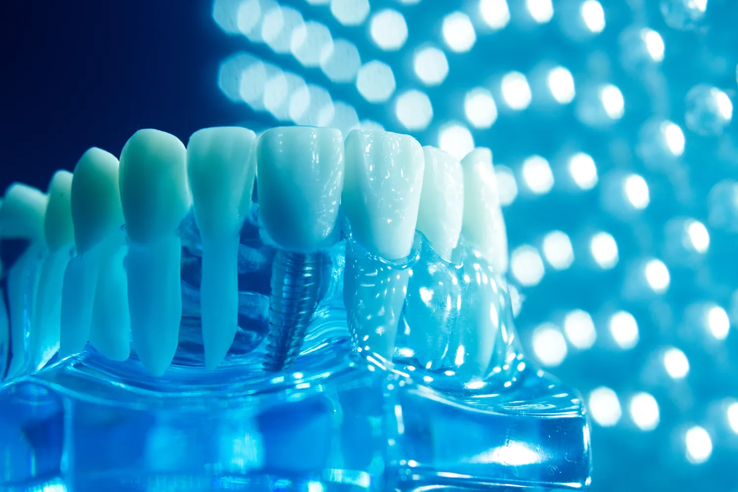 Najlepszy stomatolog Warszawa