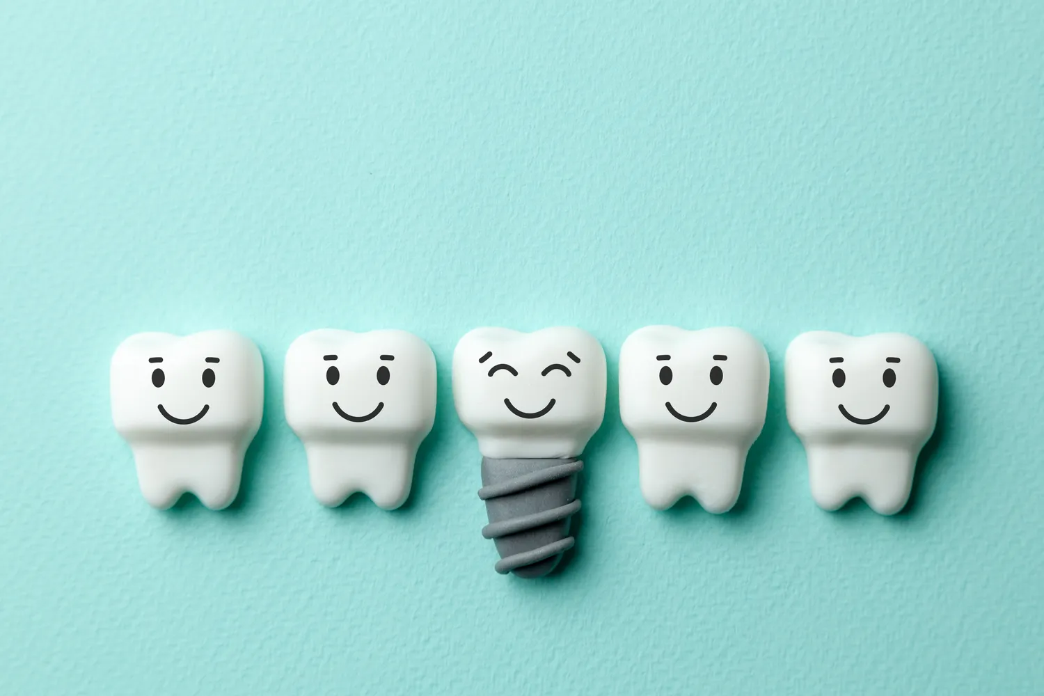 Ile kosztuje implant zęba?