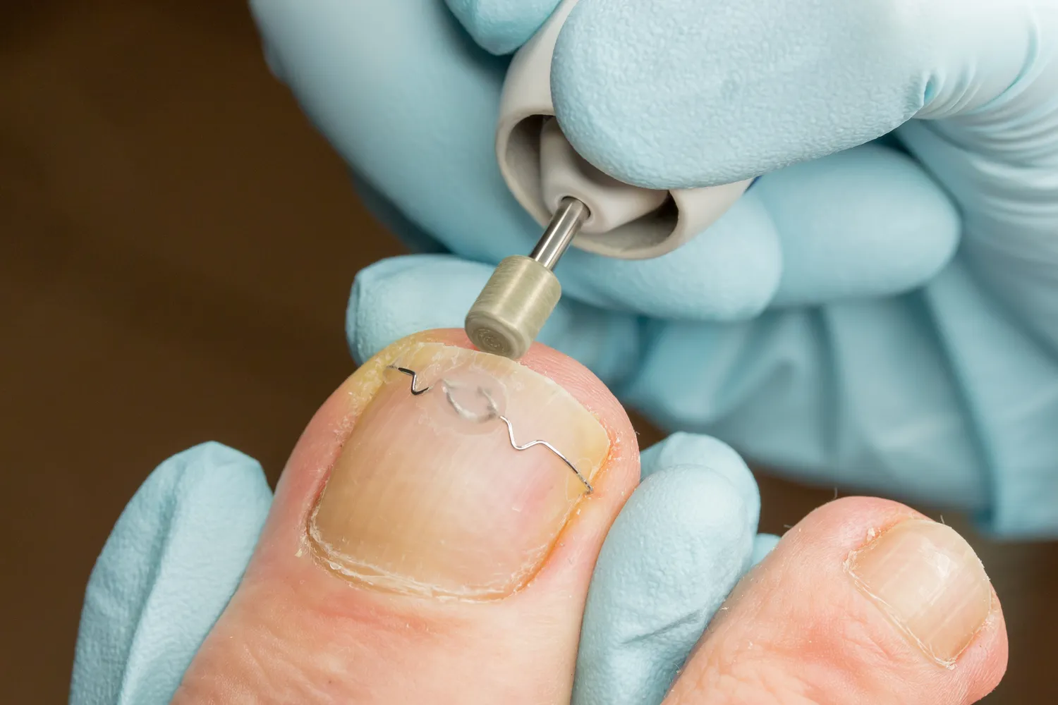 Co warto wiedzieć o leczniczym pedicure?