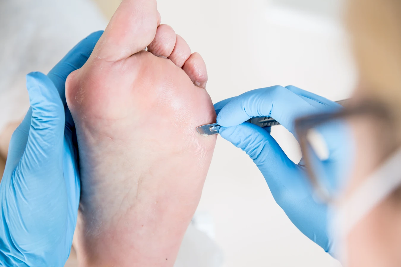 Zadbaj o swoje stopy już dziś - podologia na ratunek